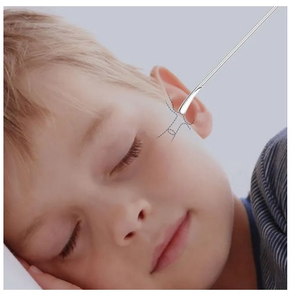 مجموعه نظافت گوش